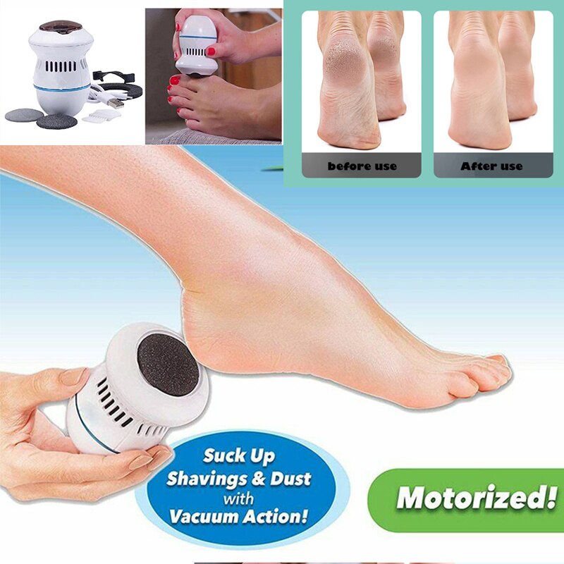 Electric Vacuum Foot Grinder BapMagic